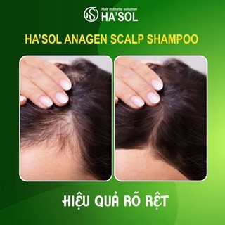 DẦU GỘI GIẢM RỤNG ,BẠC TÓC, KÍCH MỌC TÓC[ CHÍNH HÃNG ]