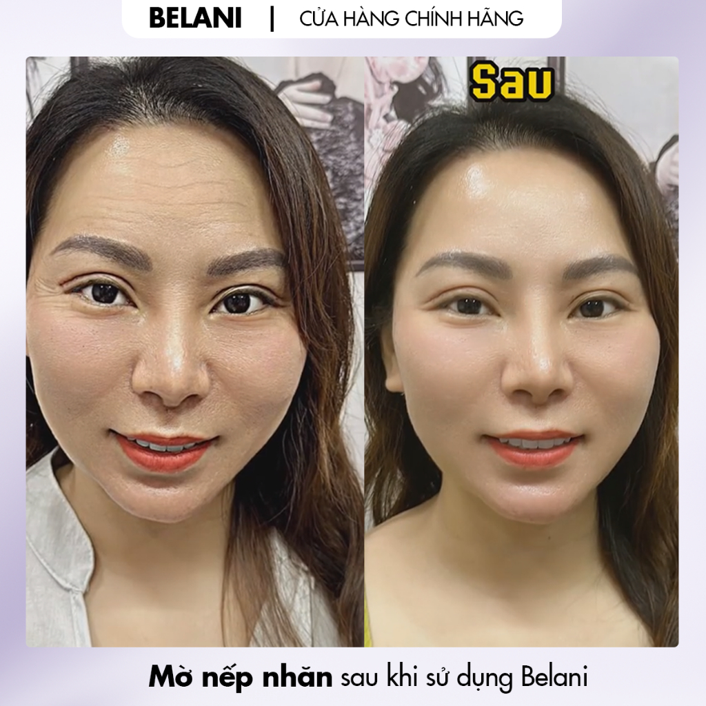 Belani Retinol 30ml Kem dưỡng ẩm MỜ NÁM & NẾP NHĂN
