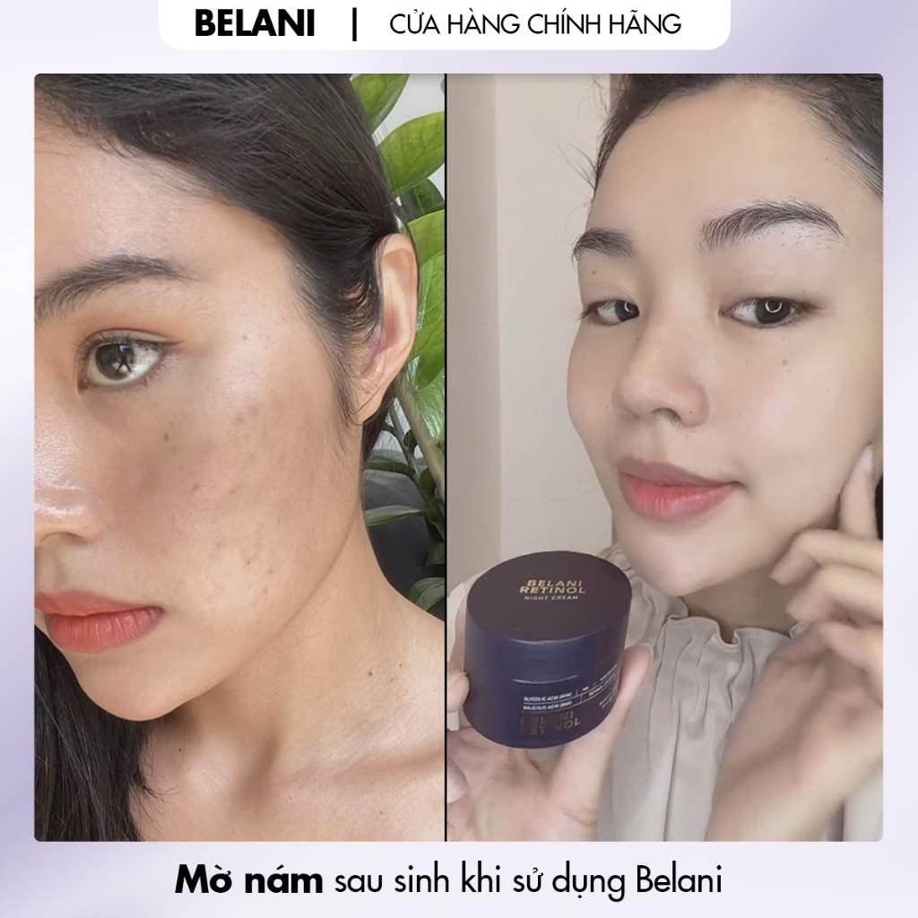 Belani Retinol 30ml Kem dưỡng ẩm MỜ NÁM & NẾP NHĂN