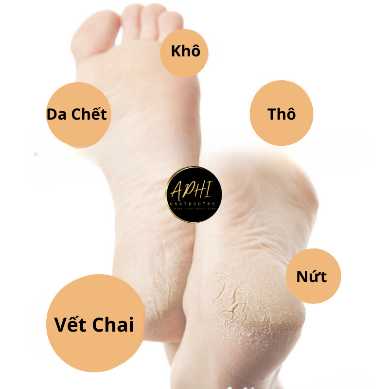 Máy Chà Gót Chân Tự Động, Tẩy Tế Bào Chết Tại Nhà Sạc Pin Tích Điện 2 Đầu Mài - FL58