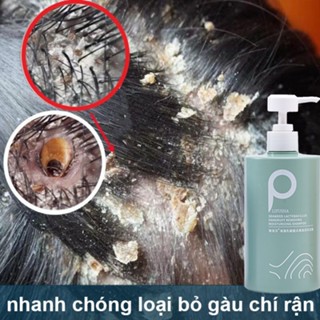 Dầu gội dầu gội trị gàu dầu gội trị nấm da đầu 500ml Làm mới kiểm soát dầu loại bỏ ngứa ngáy