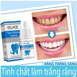 Tinh Chất Làm Trắng Răng Loại Bỏ Vết Ố Trên Răng Tiện Dụng