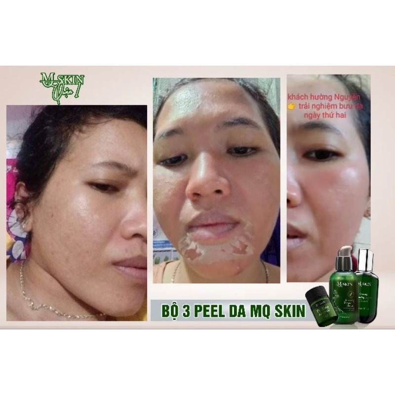 BỘ PEEL DA 7 NGÀY
