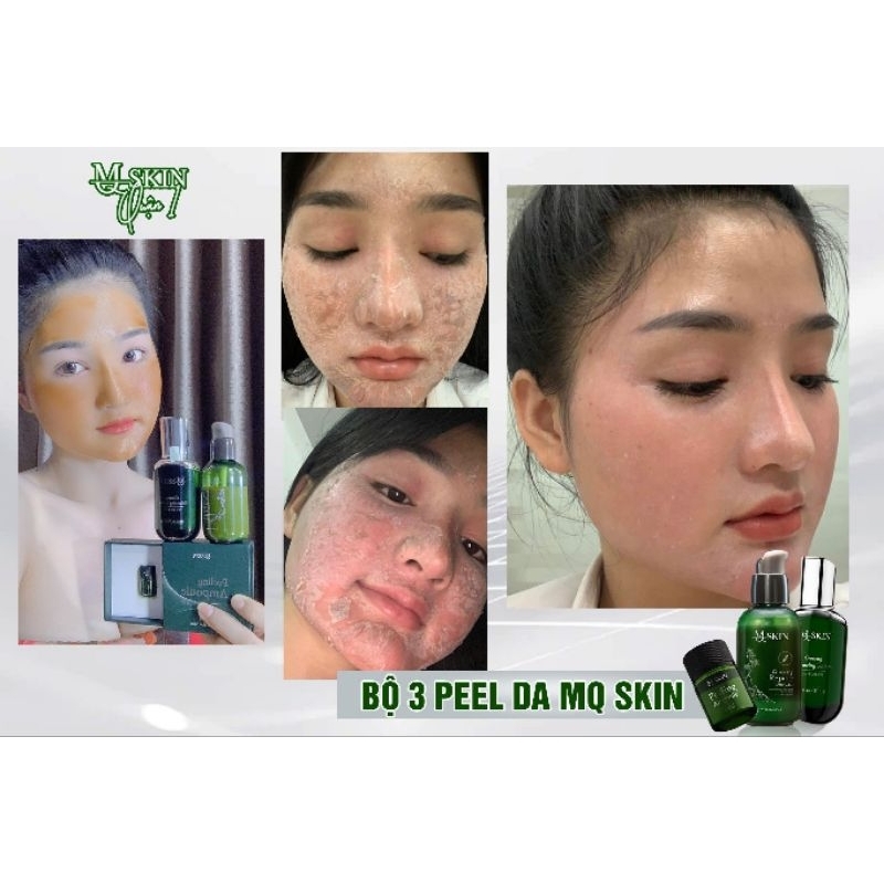 BỘ PEEL DA 7 NGÀY