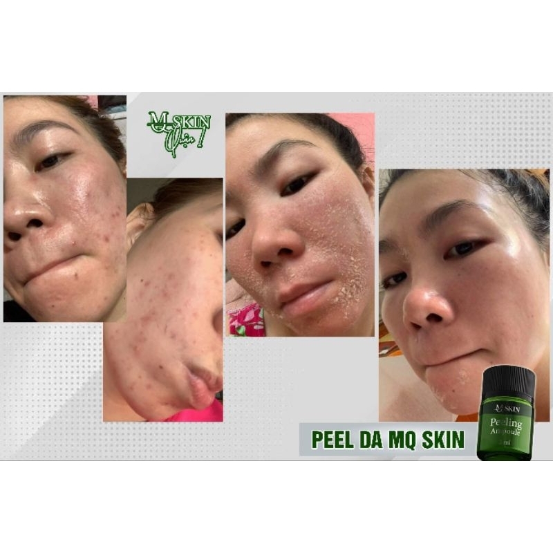 BỘ PEEL DA 7 NGÀY