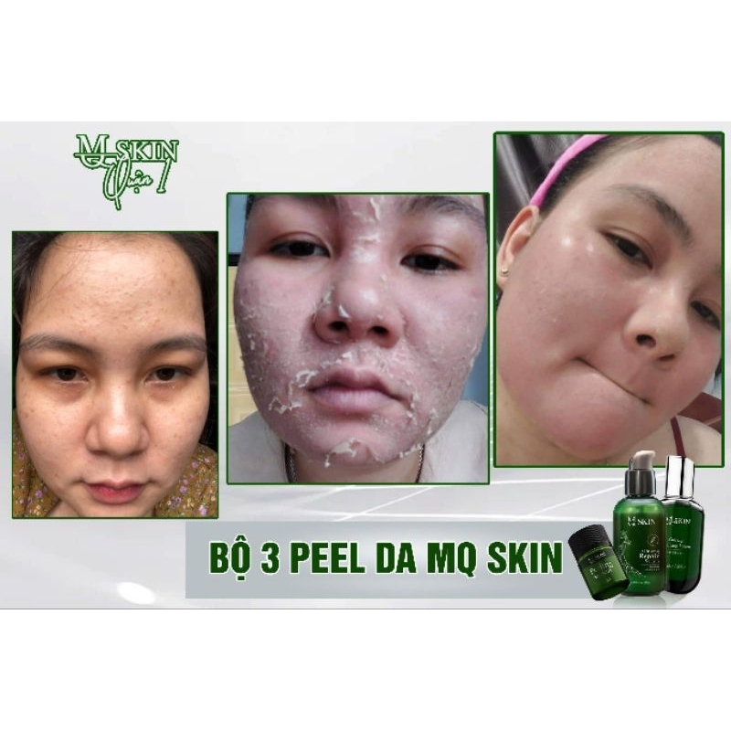 BỘ PEEL DA 7 NGÀY