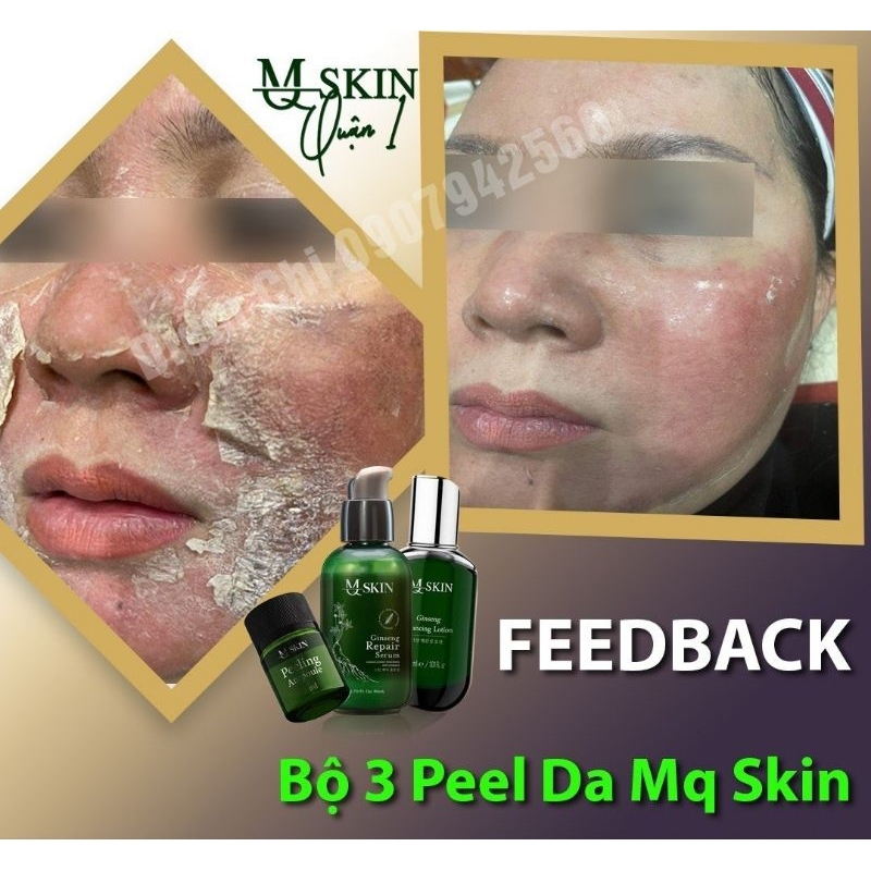 BỘ PEEL DA 7 NGÀY