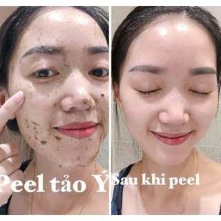 Set tảo ý peel da, căng bóng da (bột + dung dịch)