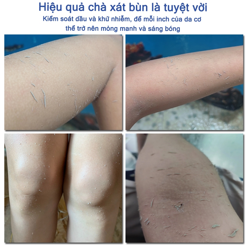 Kem tẩy tế bào chết toàn thân tẩy tế bào chết niacinamide kem tẩy tế bào chết Làm trắng, thu nhỏ lỗ chân lông 250G