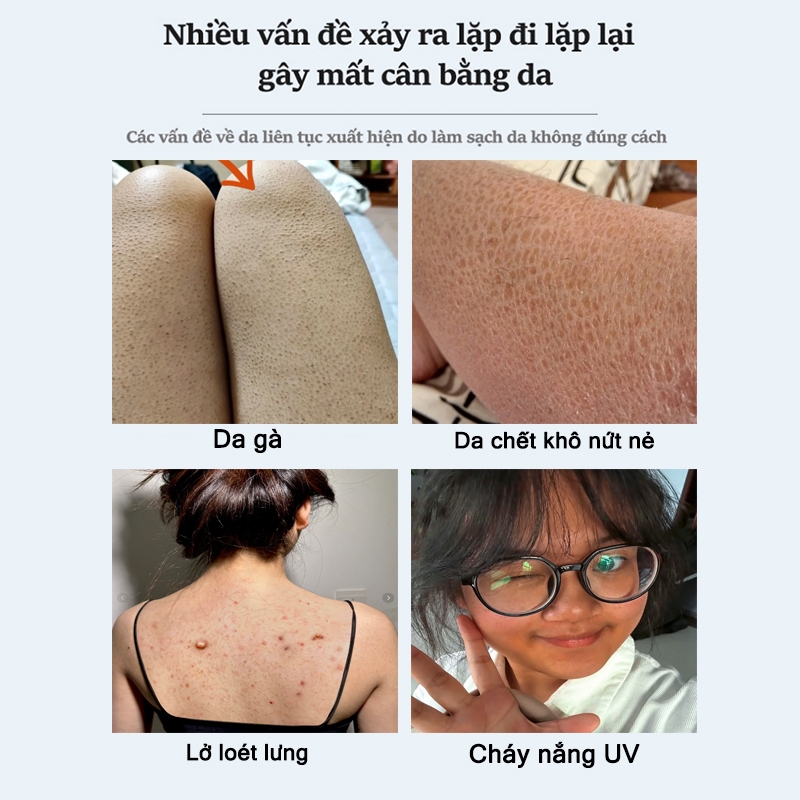 Kem tẩy tế bào chết toàn thân tẩy tế bào chết niacinamide kem tẩy tế bào chết Làm trắng, thu nhỏ lỗ chân lông 250G