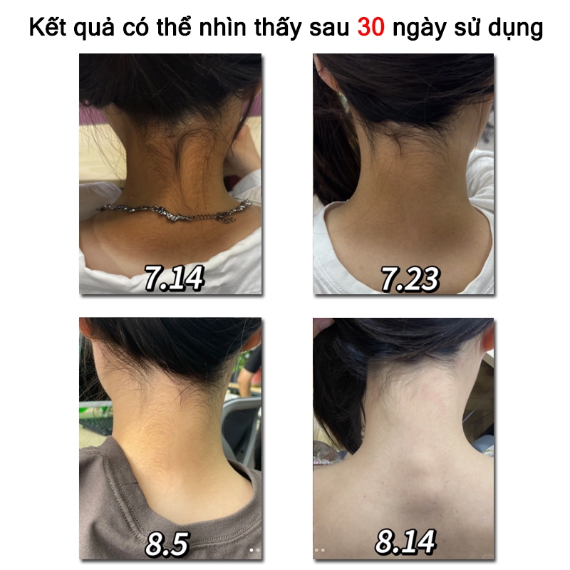 Kem tẩy tế bào chết toàn thân tẩy tế bào chết niacinamide kem tẩy tế bào chết Làm trắng, thu nhỏ lỗ chân lông 250G
