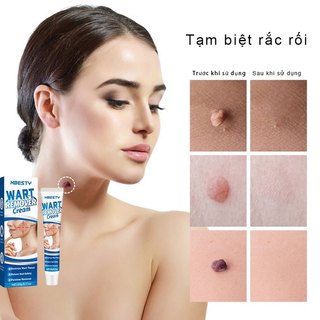 Trị mụn cóc kem loại bỏ mụn cóc 20g xóa nốt ruồi  mụn cóc mụn thịt  sạch mụn thịt thừa  mụn thịt, tàn nhang