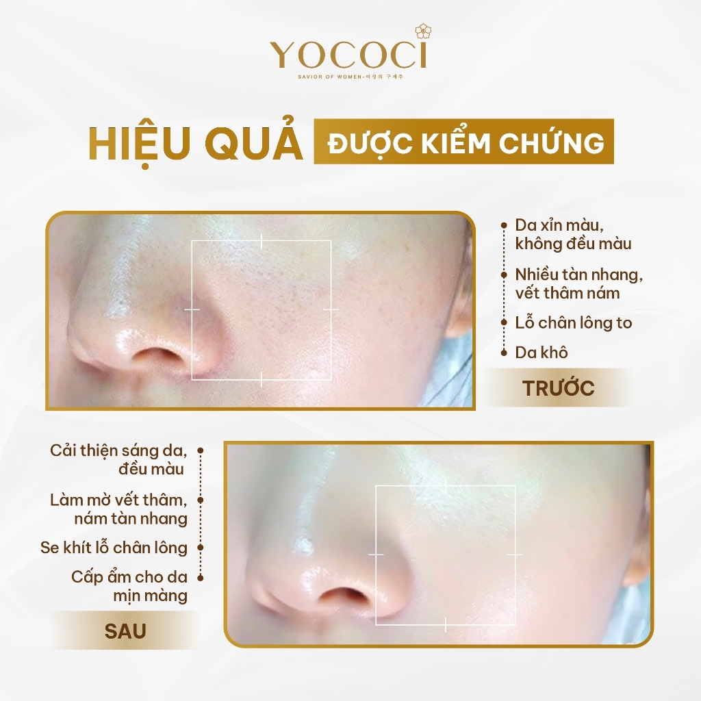 Kem dưỡng trắng da mặt Yococi White Perfect Face Cream Day Night - 20g