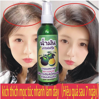 Xịt mọc tóc Bưởi Xanh Thái Lan kích thích mọc tóc , ngăn ngừa tóc gãy rụng hiệu quả 80ml