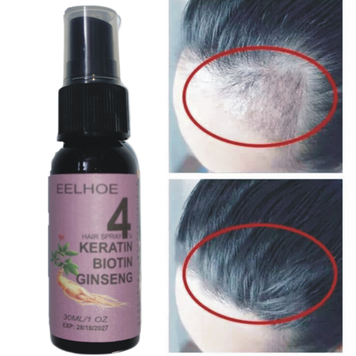 [Sỉ-Rẻ] Xịt mọc tóc Nhân sâm Biotin EELHOE Tím giảm rụng tóc, kích mọc tóc, cải thiện hói đầu, ngăn nấm da đầu 30ml [Lẻ-
