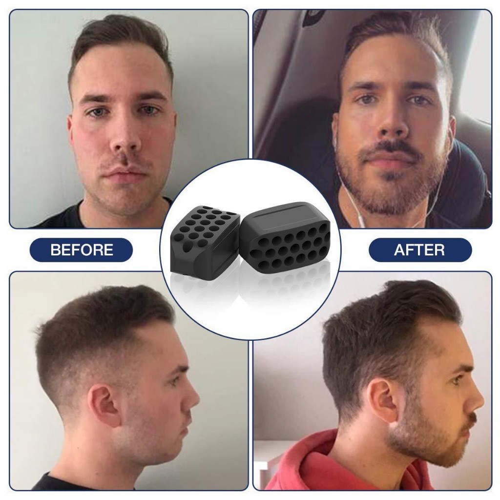 Viên Nhai Cơ Hàm Silicon Giúp Nâng Cơ Mặt Thon Gọn Cằm Dành Cho Nam Và Nữ