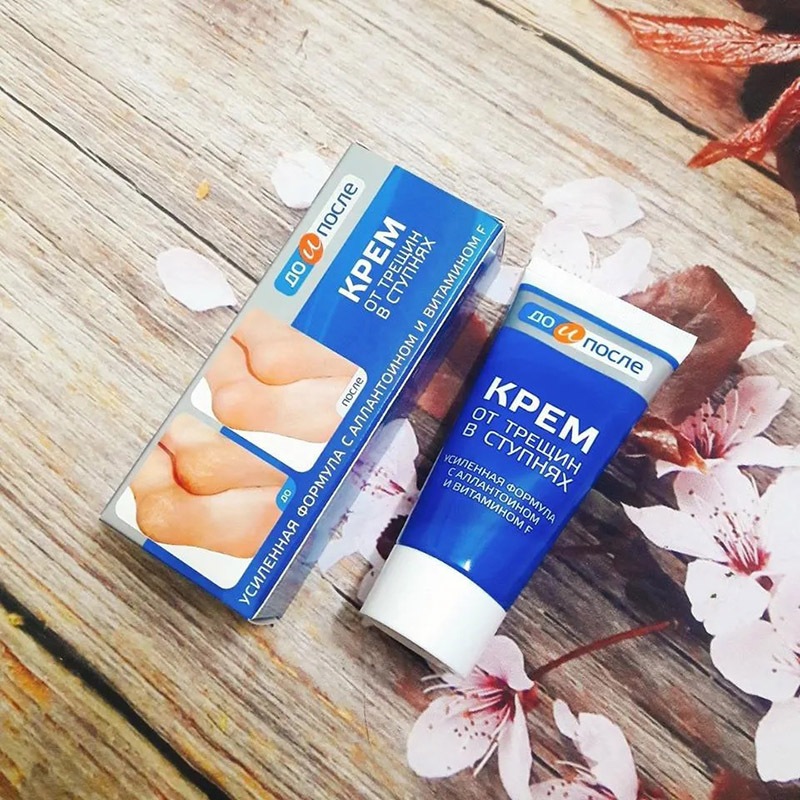 Kem Giảm Nứt Nẻ Gót Chân KPEM Nga 50ml tái tạo da và làm mềm da gót chân