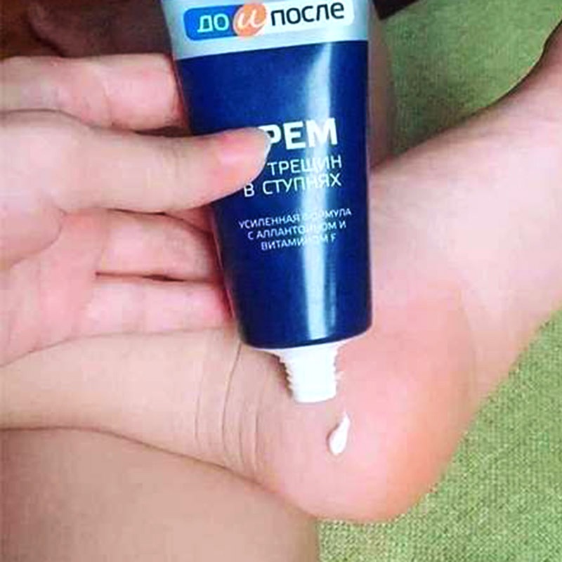 Kem Giảm Nứt Nẻ Gót Chân KPEM Nga 50ml tái tạo da và làm mềm da gót chân