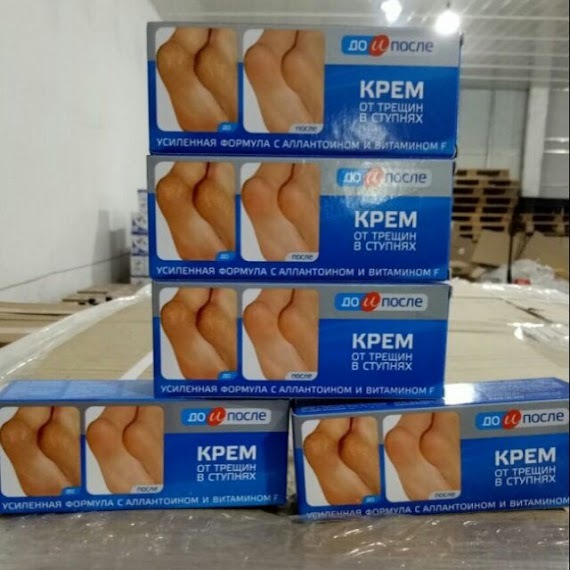 Kem Giảm Nứt Nẻ Gót Chân KPEM Nga 50ml tái tạo da và làm mềm da gót chân