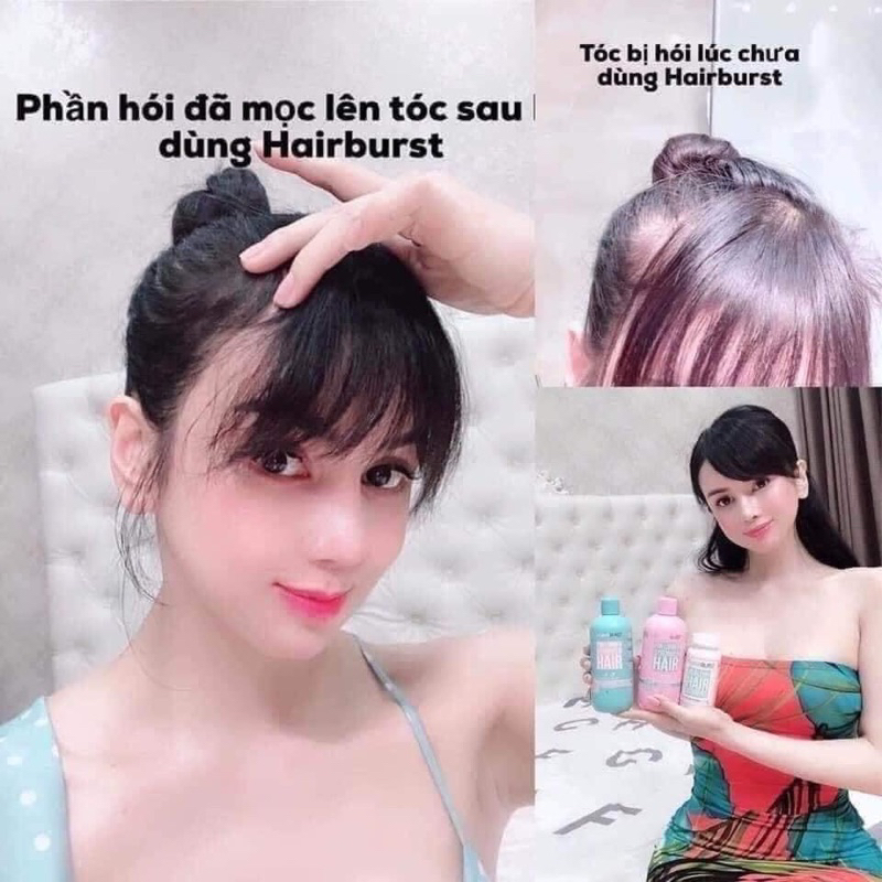 SET DẦU GỘI XẢ HAIRBURST-FOR