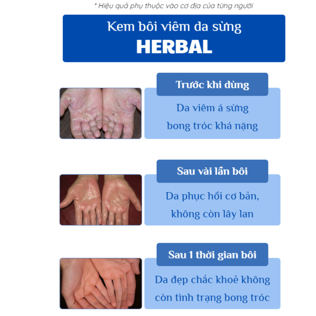 vn 11134207 7r98o lnjqkz9v504t45