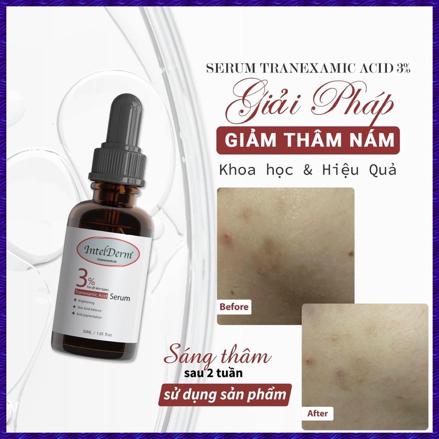 Serum Tranexamic acid 3% Intelderm sáng da mờ thâm nám thâm mụn,cấp ẩm cho da