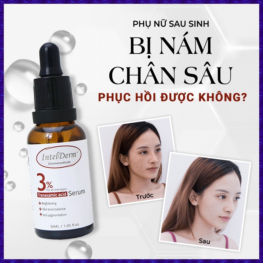Serum Tranexamic acid 3% Intelderm sáng da mờ thâm nám thâm mụn,cấp ẩm cho da