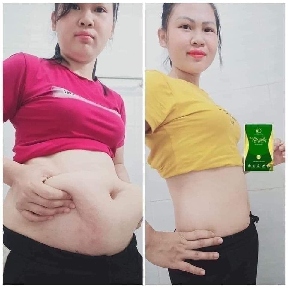 Kẹo Giảm Cân NioSLim Chính Hãng Mẫu Mới 2023