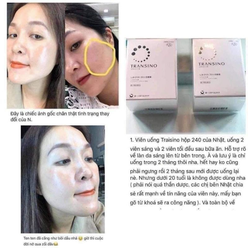 Viên Uống Mờ Nám,Tàn Nhang,Làm Trắng Da Transino Whitening Nhật Bản 240 Viên,Transino Bạc