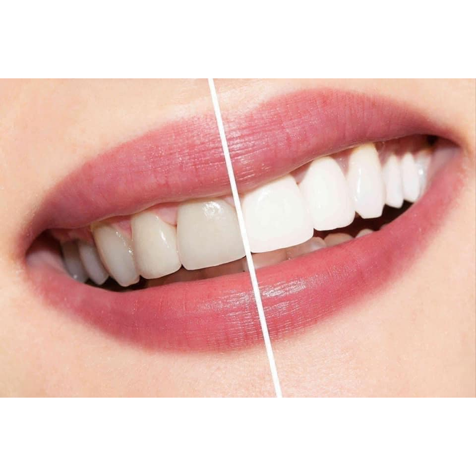 Nước Súc Miệng Crest Pro Health Advance - 1000ml