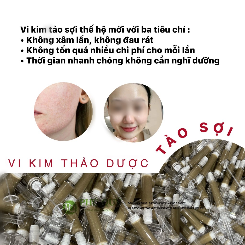 Vi Tảo Rải Sợi Peel Da
