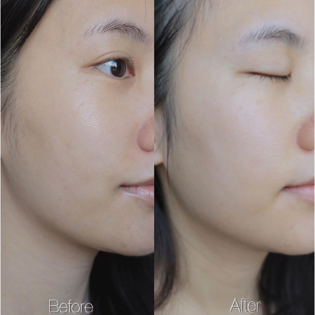 Kem Dưỡng L'Oreal Paris Sáng Mịn Glycolic-Bright Glowing Cream Day SPF 17, Night