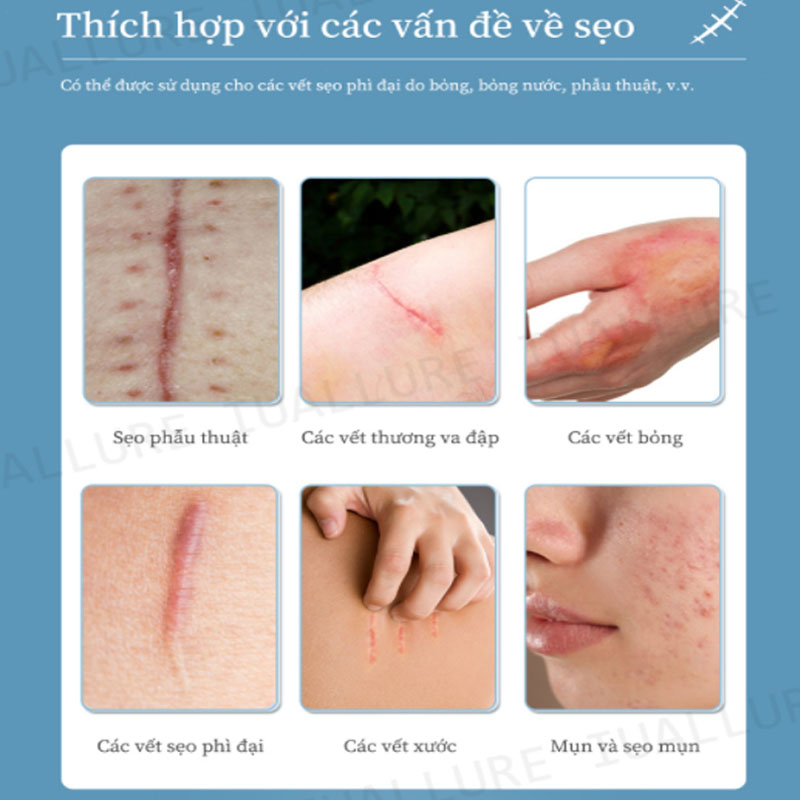 Kem mờ sẹo mờ thâm sẹo lồi sẹo lõm sẹo do mụn và giảm rạn da hiệu quả 20g nhanh chóng làm mờ sẹo lồi sẹo lõm