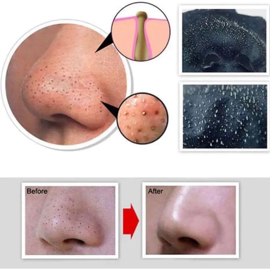 GEL LỘT LỤN THAN TRE PHÁP  Hút sạch mụn và bụi bẩn 30g