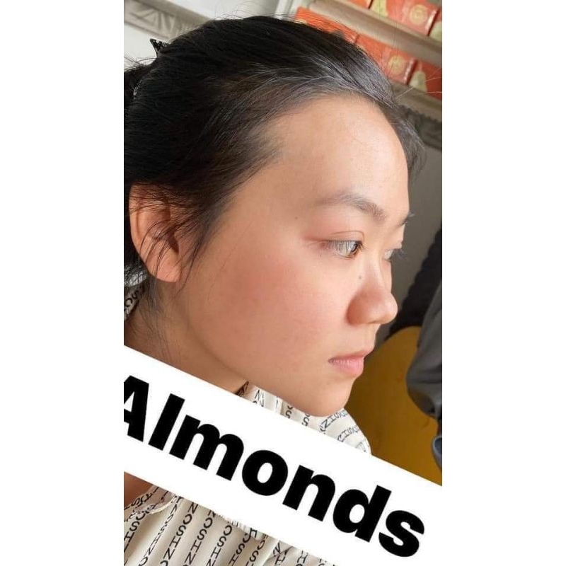 CAO MỤN THÂM ALMOMDS