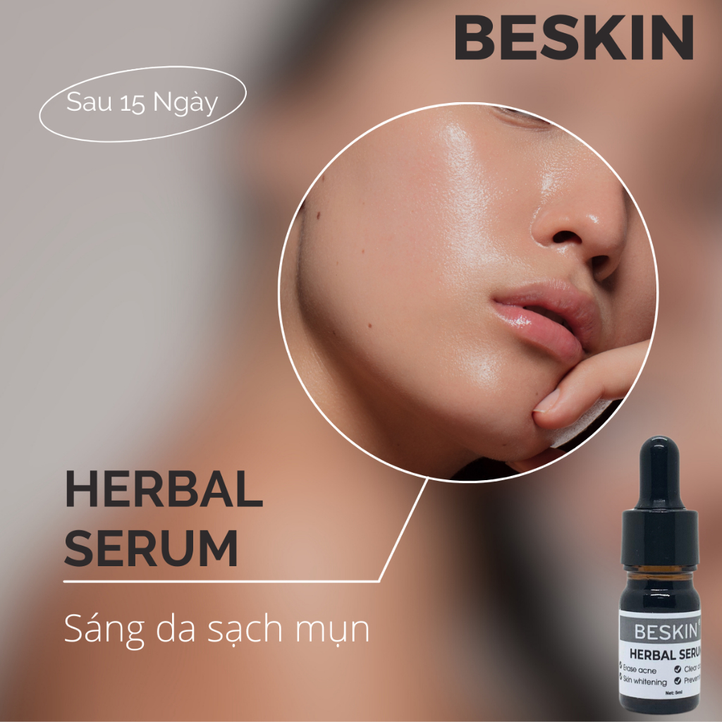 Serum Mụn Beskin Herbal  Giúp Sạch Mụn, Mờ Thâm Dưỡng Trắng Da Mặt 5ml