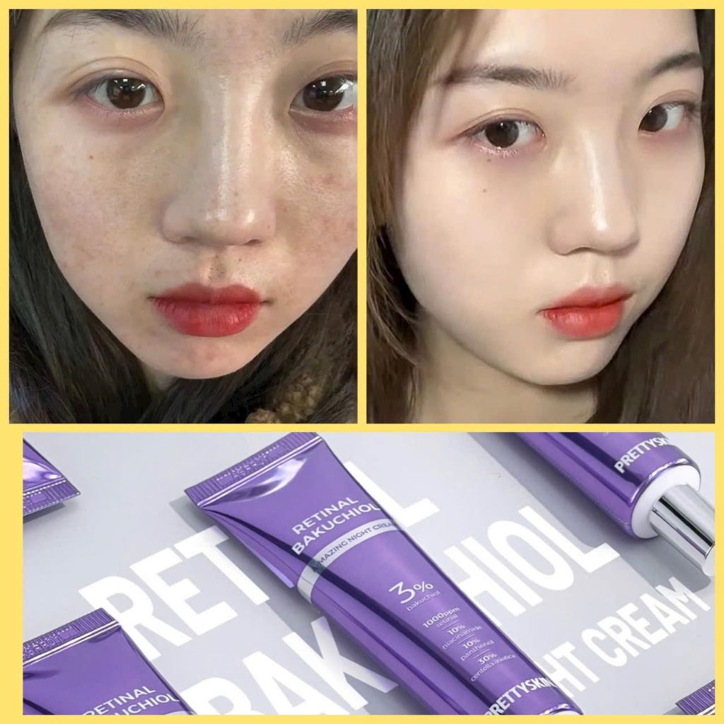 Prettyskin ,Retinol, kem dưỡng Pretty Skin retinal bakuchiol A-mazing night cream,tái tạo trẻ hóa , căng bóng đều màu da