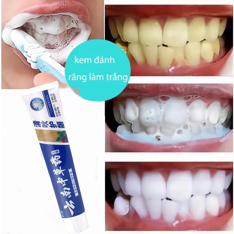 Kem Đánh Răng Làm Trắng Răng 180g Loại bỏ hiệu quả Hơi thở hôi vôi răng răng vàng mảng bám vi khuẩn Giảm sâu răng