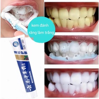 Kem Đánh Răng Làm Trắng Răng 180g Loại bỏ hiệu quả Hơi thở hôi vôi răng răng vàng mảng bám vi khuẩn Giảm sâu răng