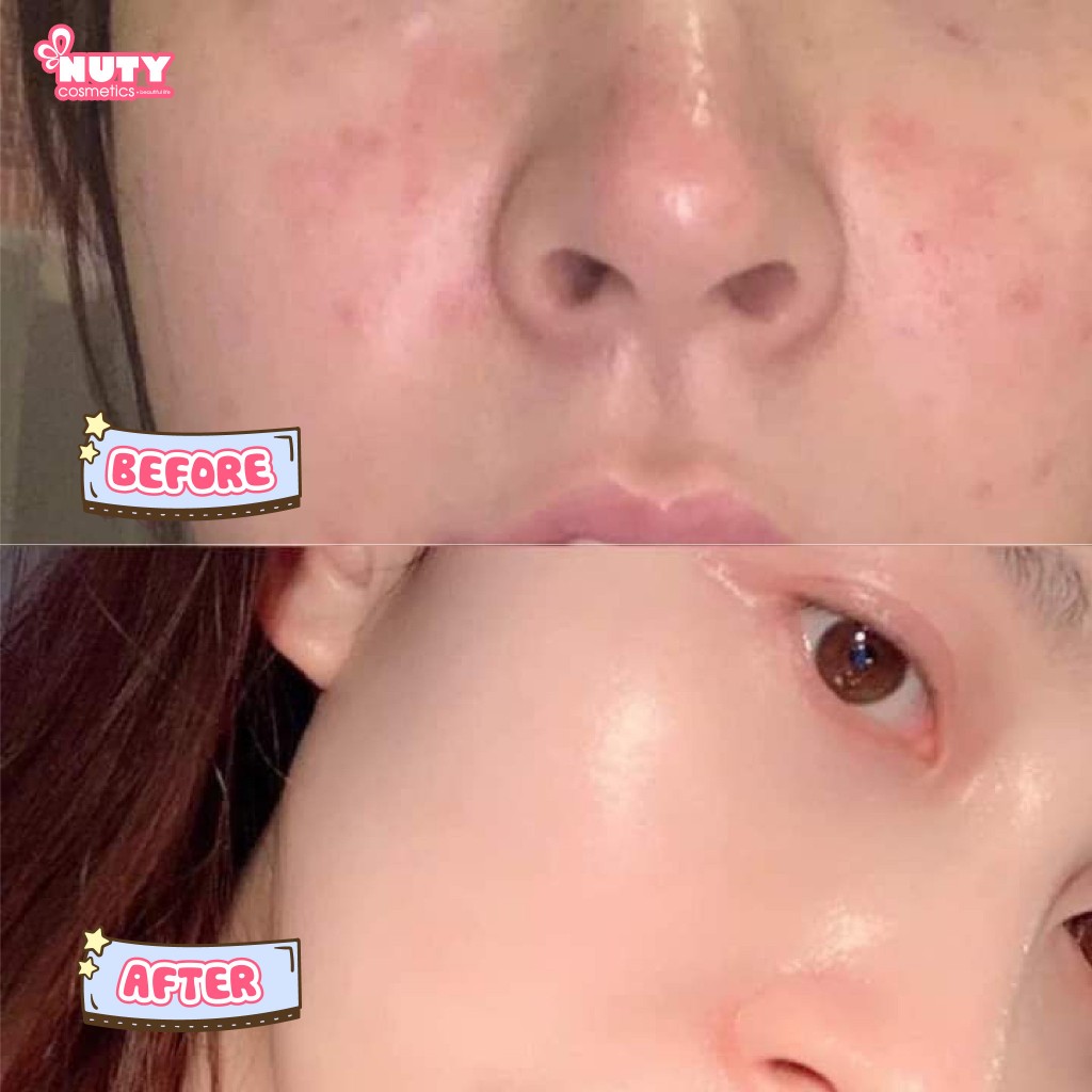 Kẹo Dẻo Collagen Hàn Quốc BOTO GUMMY (30 viên/túi)