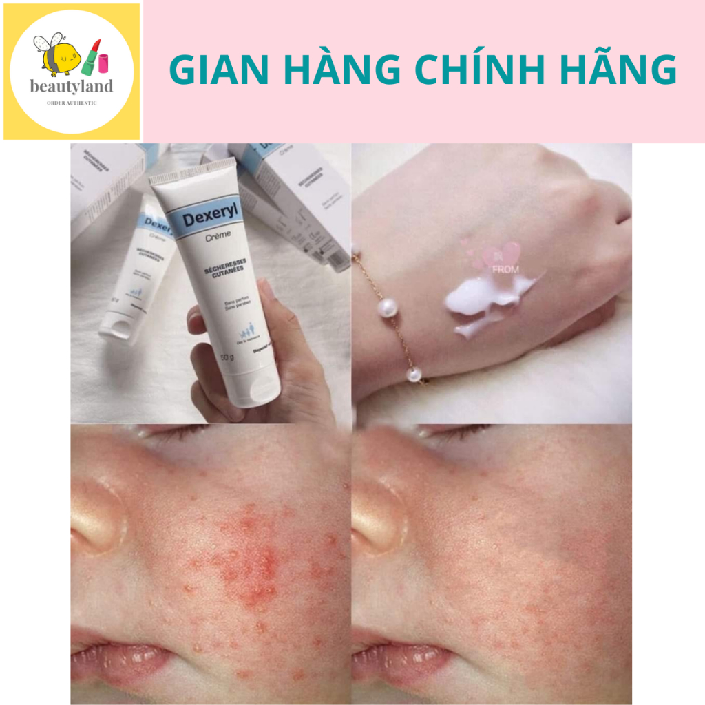 Kem nẻ chàm Pháp Dexeryl Cream 250g cho bé và gia đình