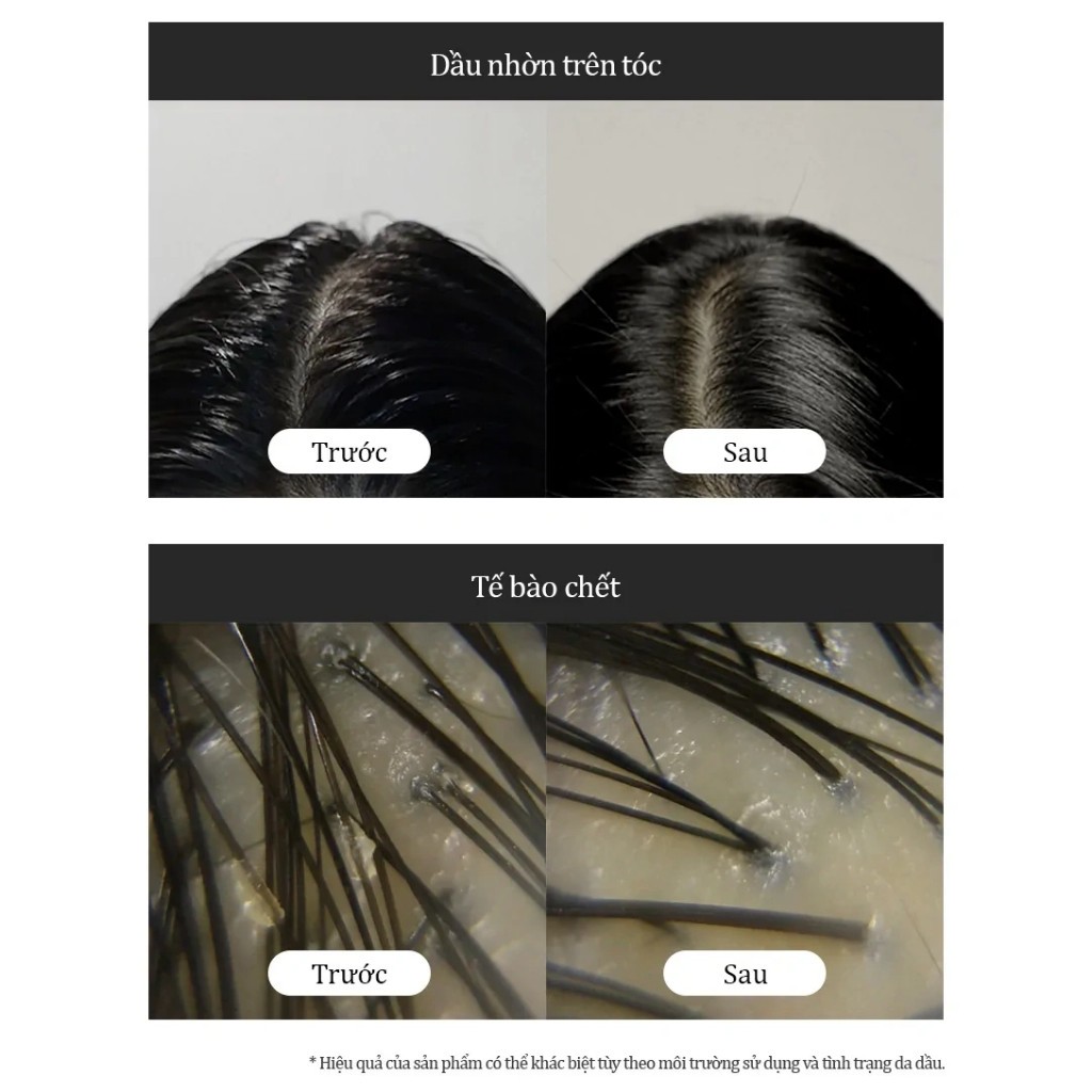 Tẩy da chết da đầu giảm rụng, chống bết, khoẻ chân tóc & giảm gàu ngứa Growus Sea Salt