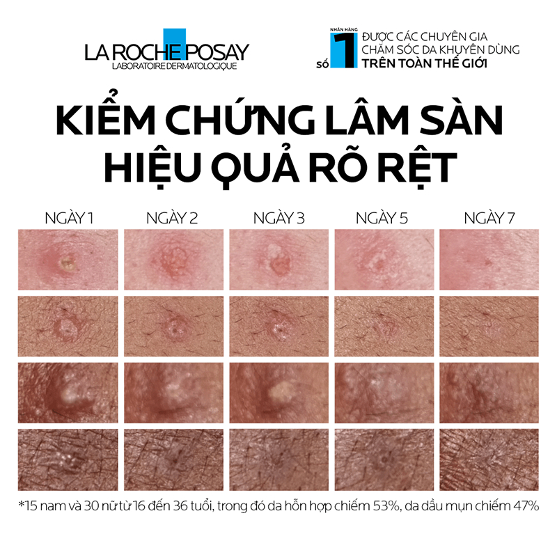 Kem dưỡng giảm mụn nhanh sau 8 giờ La Roche-Posay Effaclar Duo+ M 40ml