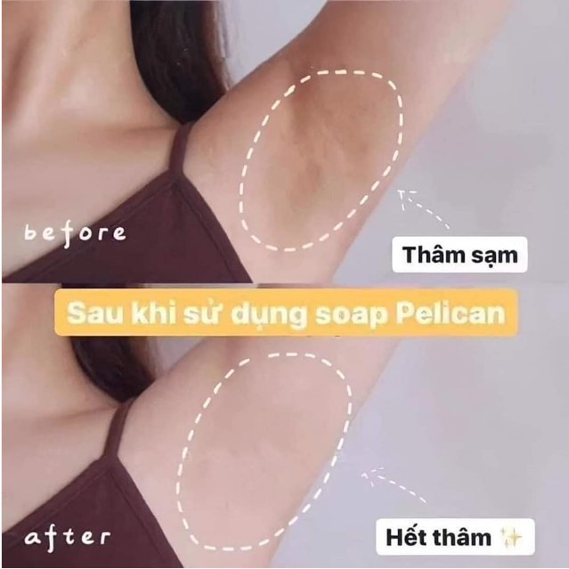 Xà Phòng Vùng Nách Pelican Cleansing Soap For Black