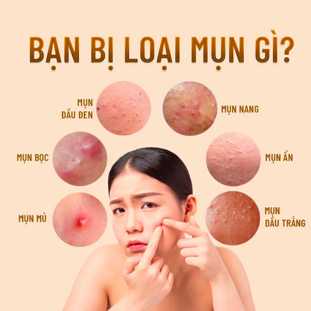 Bộ 2 kem mụn Mù U - Tamanu Cream, Sữa rửa mặt Olong Gel Dr.Luvis