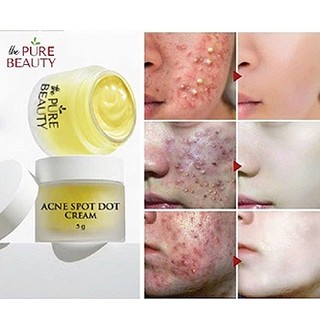 Kem Acne Spot Dot Cream xóa mụn, mờ thâm làm sáng da