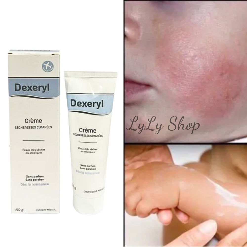 Kem Nẻ Dexeryl Creme chính hãng Pháp mẫu mới, Dưỡng da khô, nứt nẻ, chàm sữa cho bé từ sơ sinh Lylyshop 50g