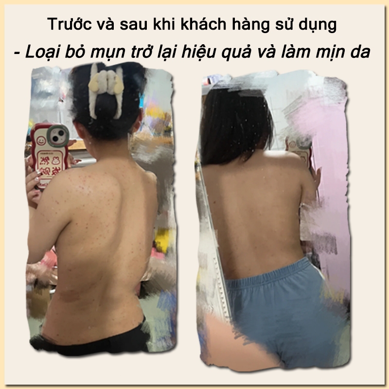 Sữa tắm tẩy tế bào chết sữa tắm làm trắng da sữa tắm sữa dê Làm trắng, nuôi dưỡng da, tẩy tế bào chết, tẩy mụn 500ml