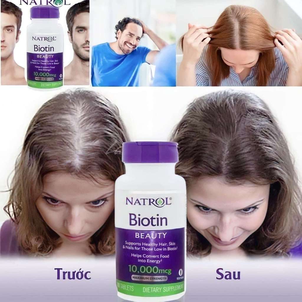 Viên Uống Natrol Biotin 10,000mcg Của Mỹ Hộp 100 Viên giúp kích mọc tóc, giảm gãy rụng