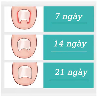 Combo Dưỡng móng và serum Nấm móng